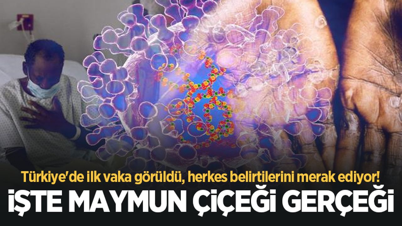 İşte Türkiye'de de görülen Maymun Çiçeği virüsüyle ilgili tüm soruların yanıtları!