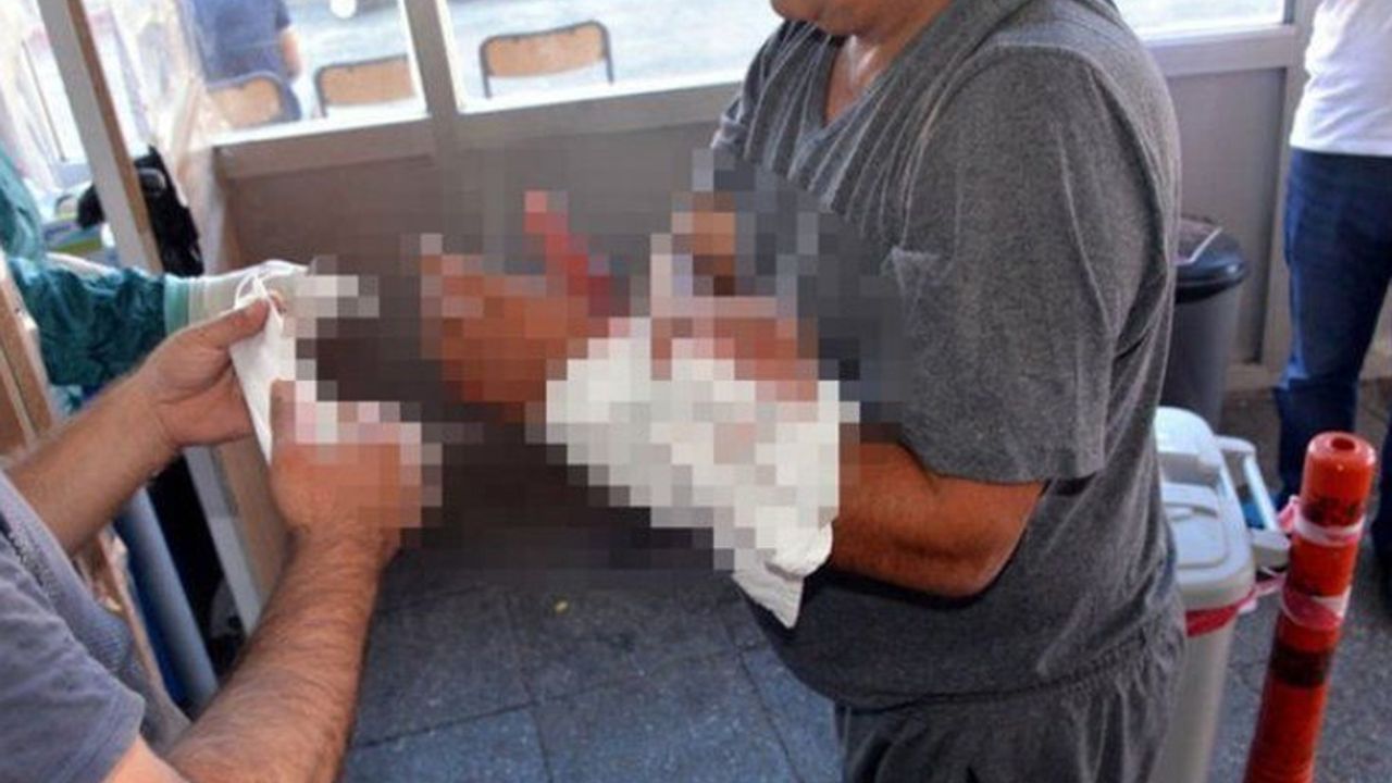 Sakarya'da 310 kişi kurbanlık keserken yaralandı!