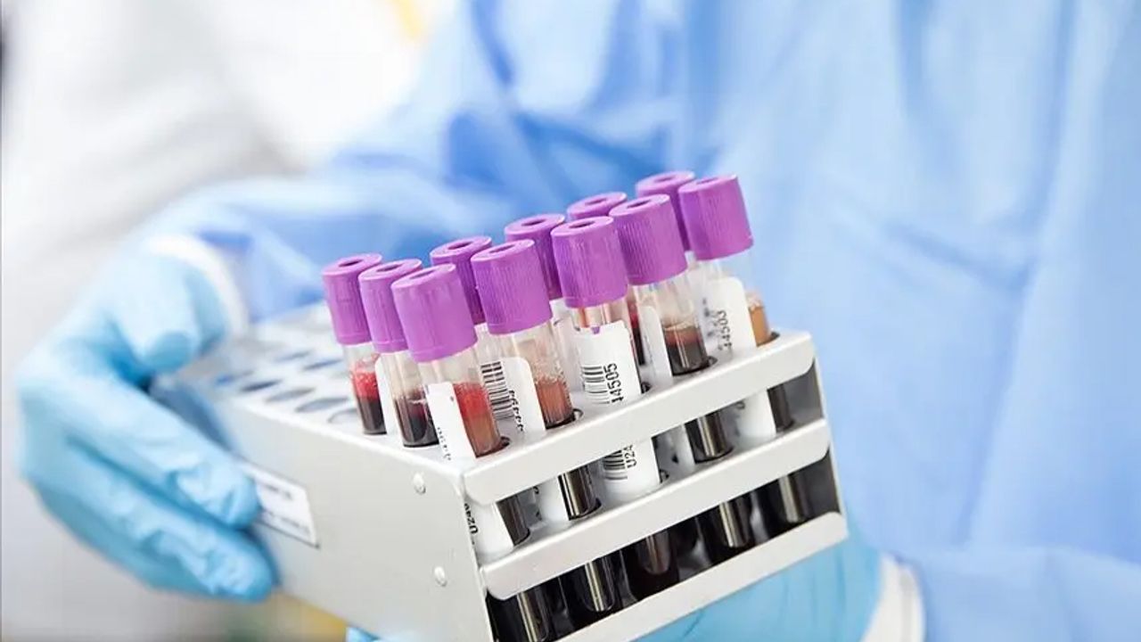 Kan grubu A olanlar için korkutan araştırma: Risk çok daha yüksek