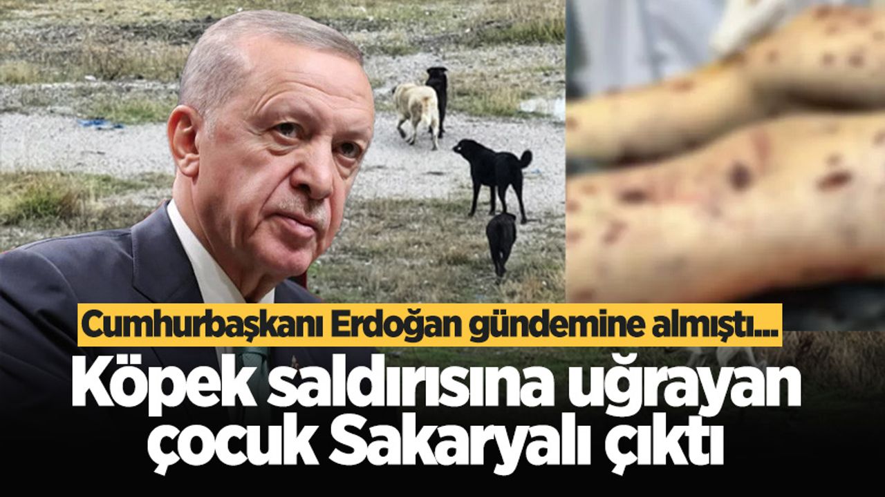 Cumhurbaşkanı Erdoğan gündemine almıştı... Köpek saldırısına uğrayan çocuk Sakaryalı çıktı