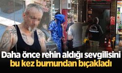 Daha önce rehin aldığı sevgilisini bu kez burnundan bıçakladı