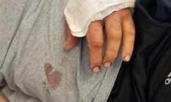 Ayının saldırısına uğrayan çiftçi dehşet anlarını anlattı: "Parmağımı kopardı"