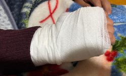 Vicdanları yaralayan olay