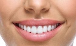 Dentopia ile Sağlıklı Gülüşlere Merhaba Deyin