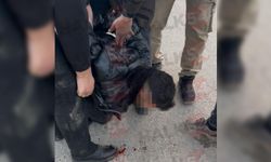 Akyazı'da hareketli anlar! 'Dur' ihtarına uymadı, yakalanınca ekiplere mukavemet sırasında yaralandı