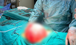 Çocuğun karnından 3,5 kiloluk kist çıktı