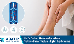 Özel Adatıp Hastanesi Op. Dr. Serkan Akcan’dan bacaklarda şişlik ve damar sağlığına ilişkin bilgilendirme
