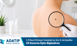 1–31 Mayıs Cilt Kanseri Farkındalık Ayı: Uzm. Dr. Aslı Şenol’dan Cilt Kanserine İlişkin Bilgilendirme