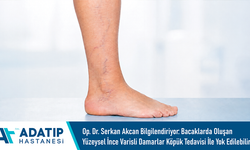 Op. Dr. Serkan Akcan bBilgilendiriyor: Bacaklarda oluşan yüzeysel ince varisli damarlar köpük tedavisi ile yok edilebili