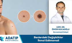 Uzm. Dr. Ömür Kocaoğlu Bilgilendiriyor: Benlerdeki Değişiklikler İhmal Edilmemeli