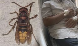 Eşek arısının soktuğu adam hastanelik oldu!