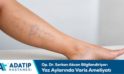 Op. Dr. Serkan Akcan bilgilendiriyor: Yaz aylarında varis ameliyatı