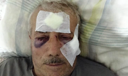 68 yaşındaki adamı muştayla darp etti