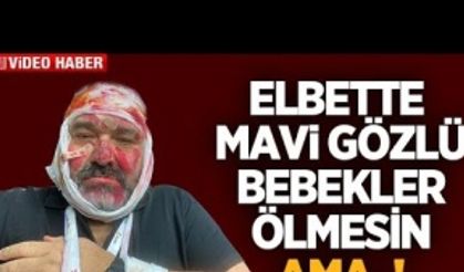 Elbette mavi gözlü bebekler ölmesin ama!