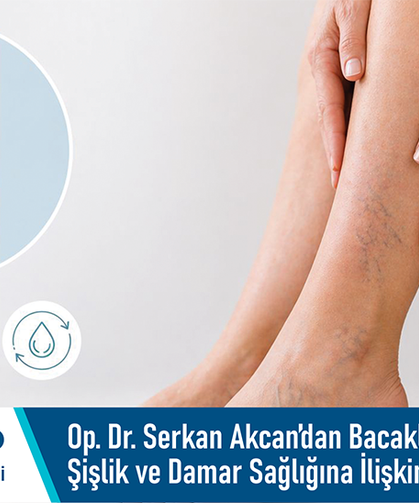 Özel Adatıp Hastanesi Op. Dr. Serkan Akcan’dan bacaklarda şişlik ve damar sağlığına ilişkin bilgilendirme