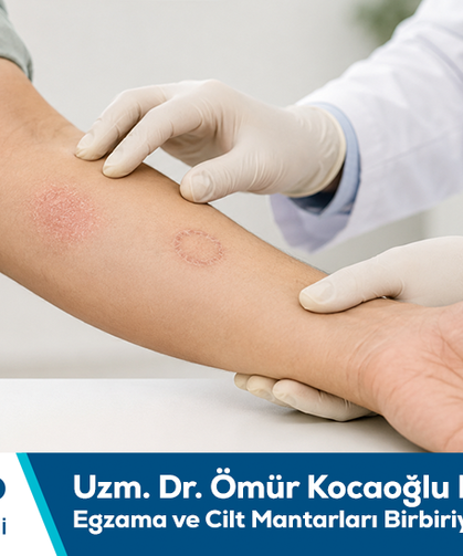 Uzm. Dr. Ömür Kocaoğlu bilgilendiriyor: Egzama ve cilt mantarları birbiriyle karıştırılmamalı