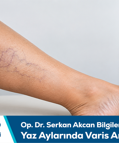 Op. Dr. Serkan Akcan bilgilendiriyor: Yaz aylarında varis ameliyatı