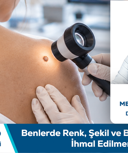 Doç. Dr. Mehmet Emin Yanık Bilgilendiriyor: Benlerde Renk, Şekil ve Boyut Değişikliği İhmal Edilmemeli