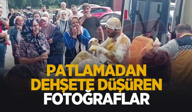 Patlama sonrası hastaneden ilk fotoğraflar