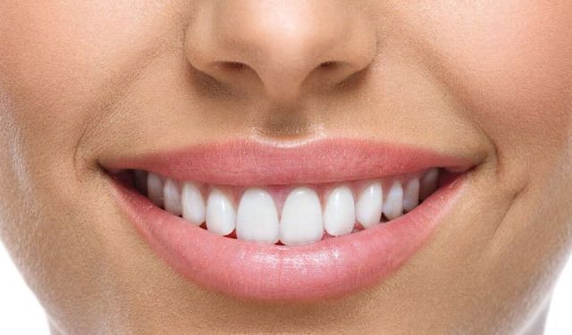 Dentopia ile Sağlıklı Gülüşlere Merhaba Deyin