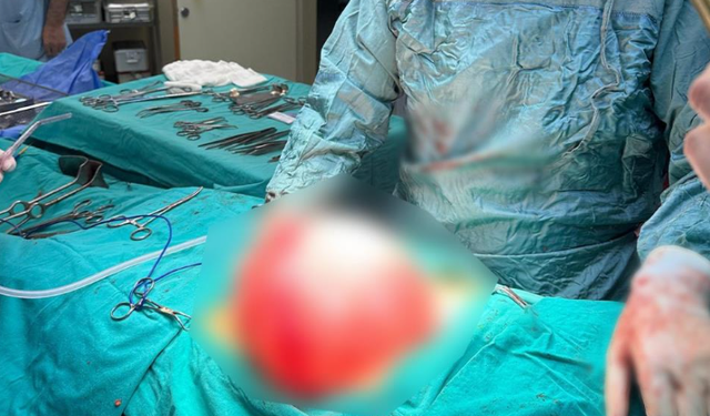 Çocuğun karnından 3,5 kiloluk kist çıktı