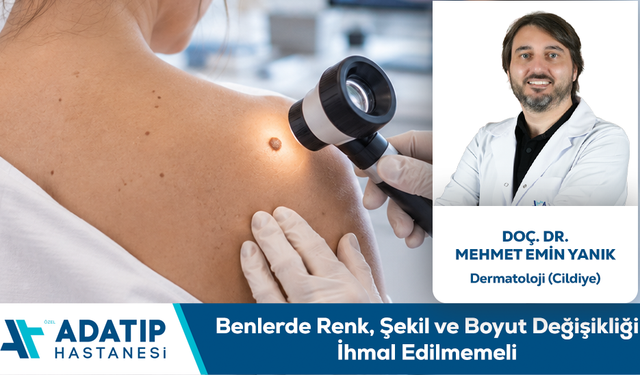 Doç. Dr. Mehmet Emin Yanık Bilgilendiriyor: Benlerde Renk, Şekil ve Boyut Değişikliği İhmal Edilmemeli