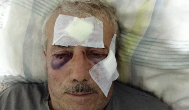 68 yaşındaki adamı muştayla darp etti
