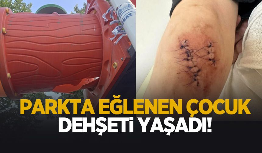 Parkta düşen çocuk yaralandı