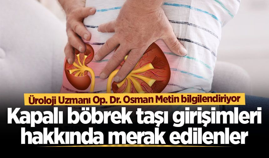 Üroloji Uzmanı Op. Dr. Osman Metin bilgilendiriyor: Kapalı böbrek taşı girişimleri hakkında merak edilenler