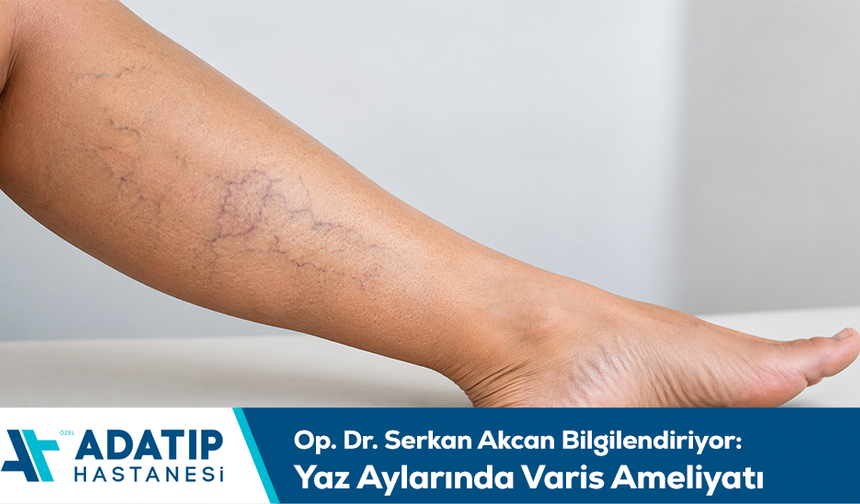 Op. Dr. Serkan Akcan bilgilendiriyor: Yaz aylarında varis ameliyatı